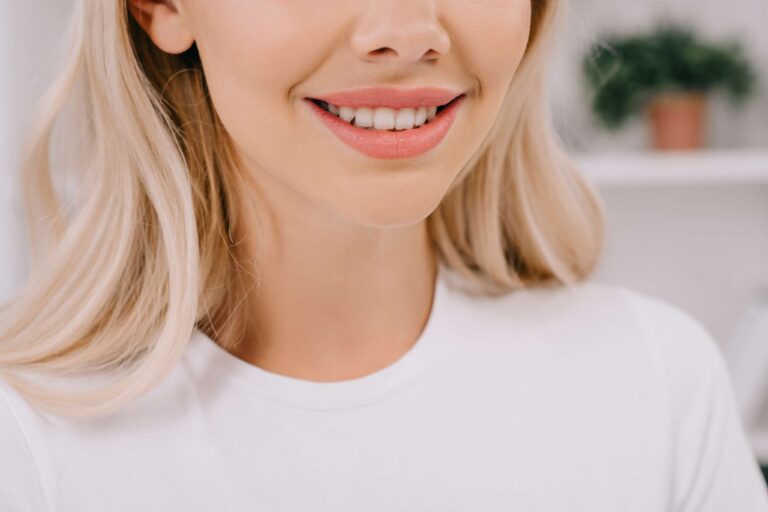 Dental-focused close-up of a woman's bright smile.